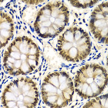 Immunohistochemistry - SNRPE Antibody (144-05488)