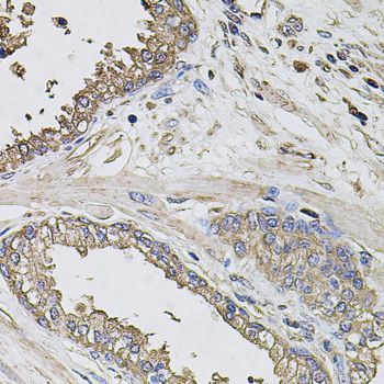 Immunohistochemistry - GRN antibody (144-012440)