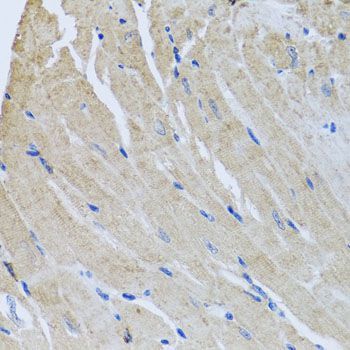 Immunohistochemistry - SRI antibody (144-06751)