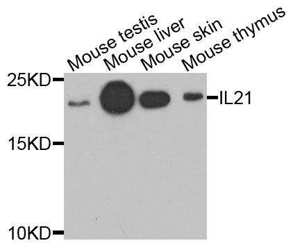 Western blot - IL21 antibody (144-07235)