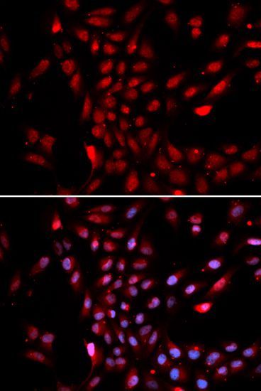 Immunofluorescence - KPNA4 antibody (144-02026)