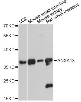 Western blot - ANXA13 antibody (144-60465)