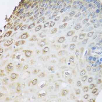 Immunohistochemistry - GRPEL2 Polyclonal Antibody (144-08339)