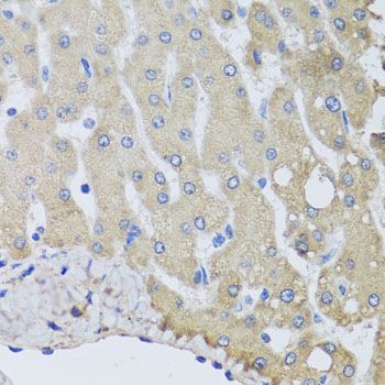 Immunohistochemistry - NSF Polyclonal Antibody (144-00926)