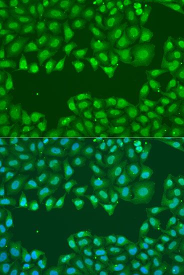 Immunofluorescence - SSB Polyclonal Antibody (144-00630)
