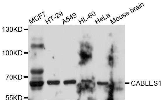 Western blot - CABLES1 Polyclonal Antibody (144-010335)
