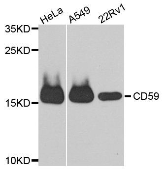 Western blot - CD59 antibody (144-012412)