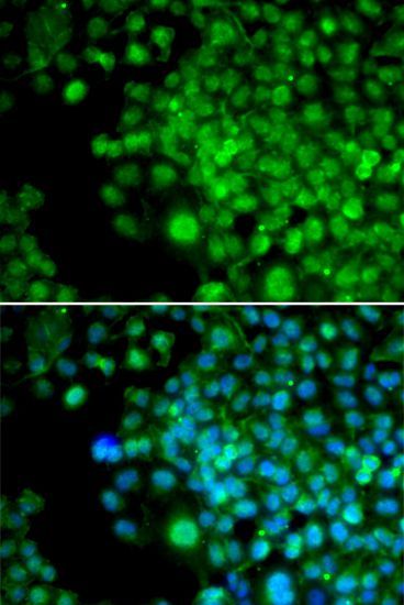 Immunofluorescence - FHL1 antibody (144-05460)
