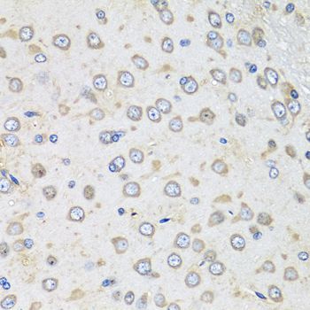 Immunohistochemistry - ALB Polyclonal Antibody (144-00353)