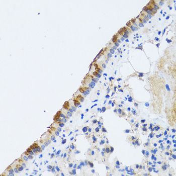 Immunohistochemistry - ST3GAL3 antibody (144-06753)