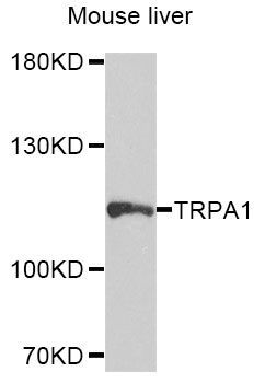 Western blot - TRPA1 Polyclonal Antibody (144-08568)