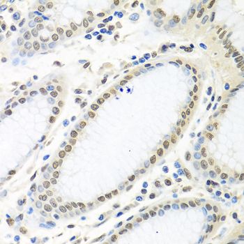Immunohistochemistry - ELAVL1 Polyclonal Antibody (144-61434)