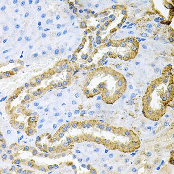 Immunohistochemistry - ABL1 Polyclonal Antibody (144-00282)