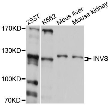 Western blot - INVS Polyclonal Antibody (144-10298)