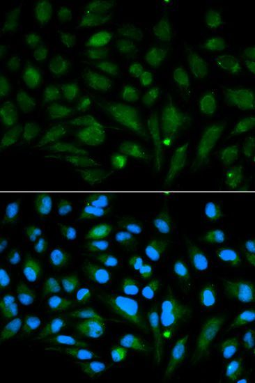 Immunofluorescence - DCN Polyclonal Antibody (144-01669)