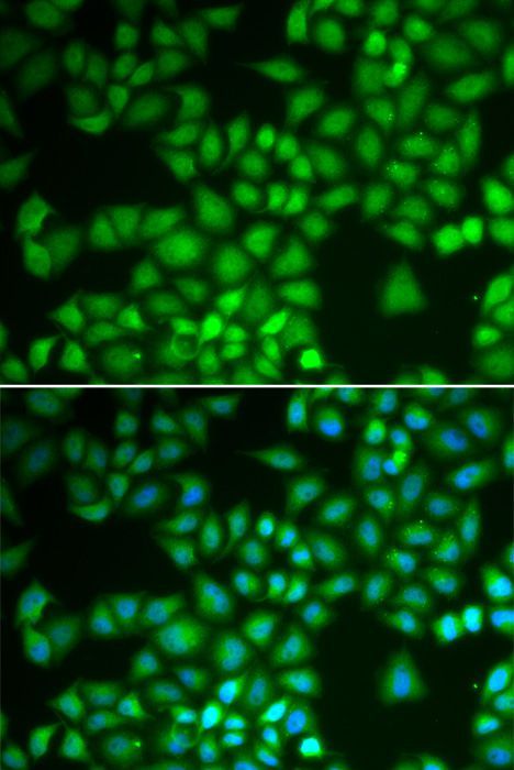 Immunohistochemistry - [KO Validated] NFKB1 Polyclonal Antibody (144-06667)