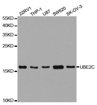 Western blot - UBE2C Polyclonal Antibody (144-05499)