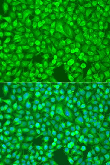 Immunofluorescence - NFKB2 antibody (144-60064)