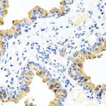 Immunohistochemistry - PIP4K2B antibody (144-08016)