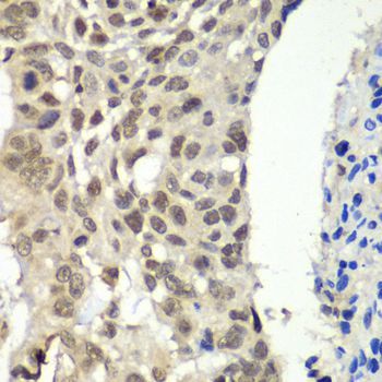 Immunohistochemistry - SSRP1 antibody (144-013636)