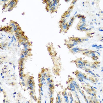 Immunohistochemistry - BCKDK antibody (144-08184)