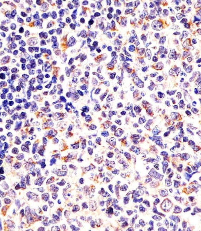 IHC-P