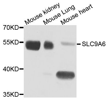 Western blot - SLC9A6 antibody (144-08187)