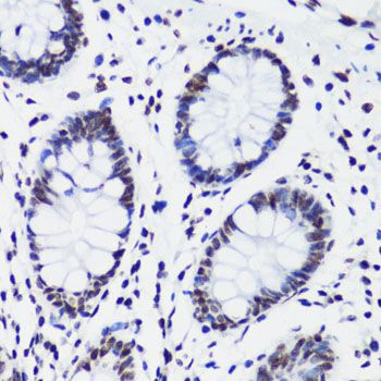 Immunohistochemistry - TriMethyl-Histone H3-K36 pAb (144-02366)