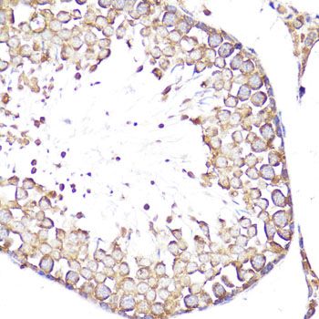 Immunohistochemistry - SELL antibody (144-01622)