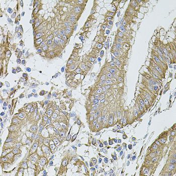 Immunohistochemistry - FLNB Polyclonal Antibody (144-02481)