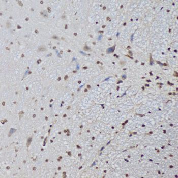 Immunoprecipitation - CTCF Polyclonal Antibody (144-01133)