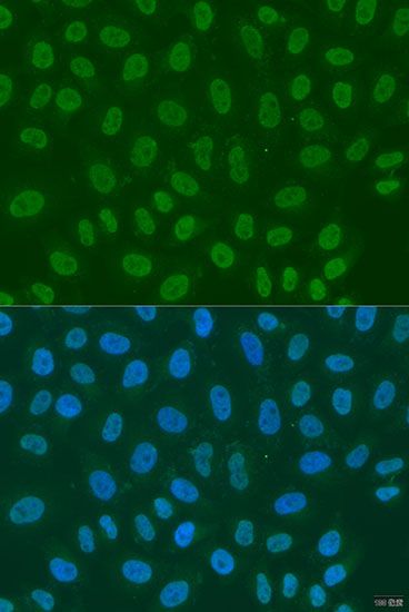 Immunofluorescence - LSM2 antibody (144-07988)