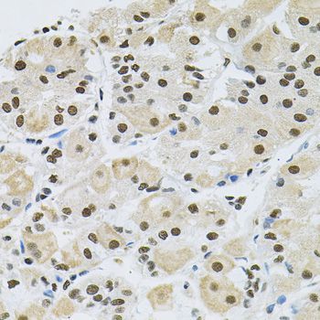 Immunohistochemistry - MAPK8 Polyclonal Antibody (144-00288)