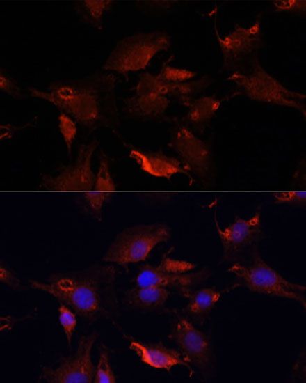 Immunofluorescence - TYMS Polyclonal Antibody (144-010441)