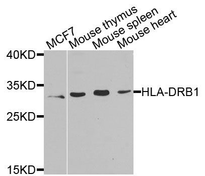 Western blot - HLA-DRB1 antibody (144-07685)