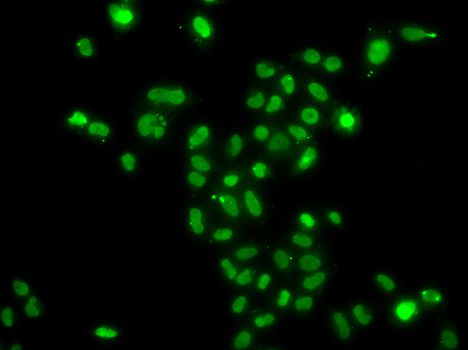 Western blot