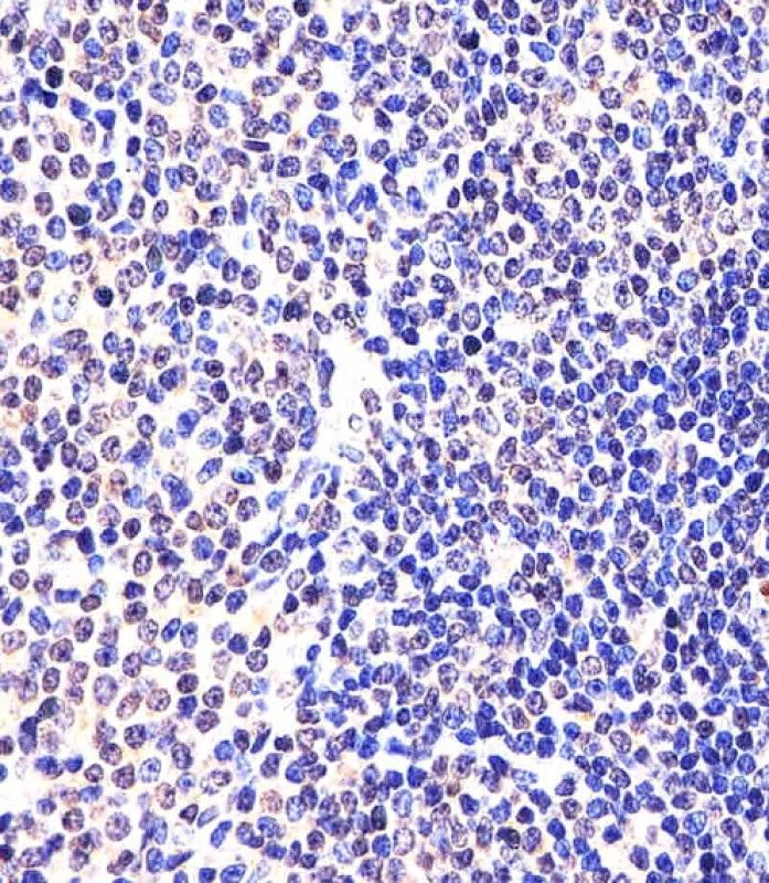IHC-P