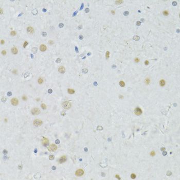 Immunohistochemistry - BRCA1 Polyclonal Antibody (144-11549)