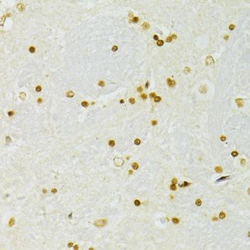 Immunohistochemistry - ADAR Polyclonal Antibody (144-07869)