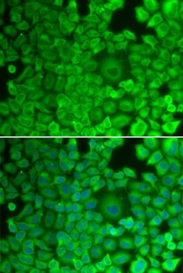 Immunofluorescence - GYS1 antibody (144-02519)