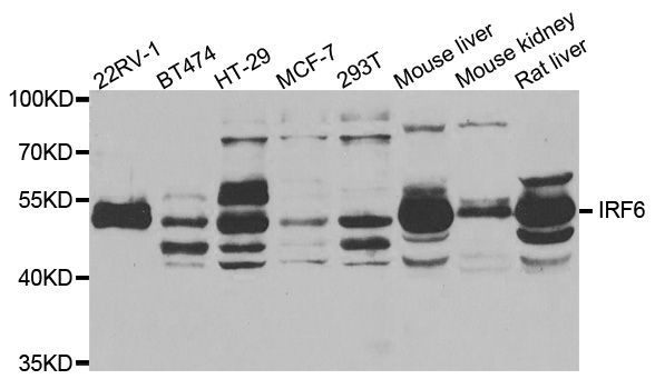 Western blot - IRF6 antibody (144-06246)