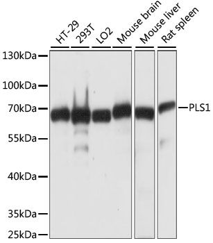 Western blot - PLS1 antibody (144-60987)