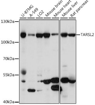 Western blot - TARSL2 antibody (144-015945)