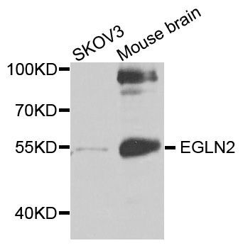 Western blot - EGLN2 Polyclonal Antibody (144-02252)