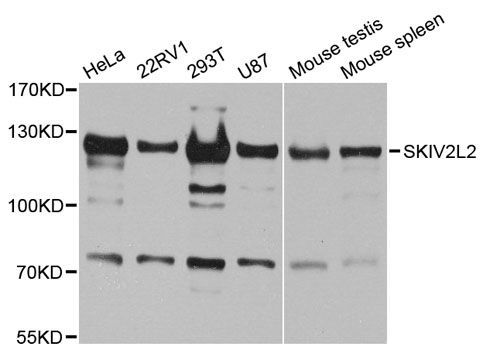 Western blot - SKIV2L2 antibody (144-05576)