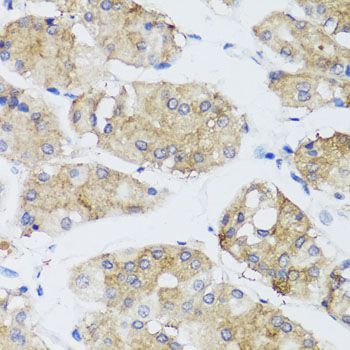 Immunohistochemistry - FGF13 antibody (144-07895)
