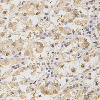 Immunohistochemistry - TOLLIP antibody (144-02202)
