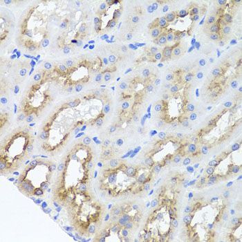 Immunohistochemistry - FLJ20294 Polyclonal Antibody (144-01083)
