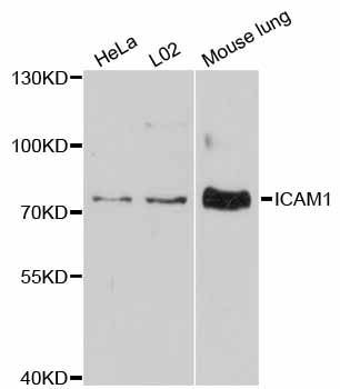 Western blot - ICAM1 antibody (144-60414)