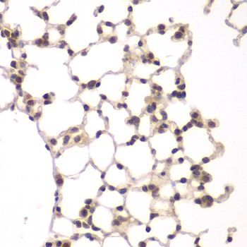 Immunohistochemistry - VRK1 Polyclonal Antibody (144-07745)